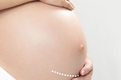 ชี้ไทยผ่าคลอดสูง ลูกเสี่ยงเป็นโรคภูมิแพ้