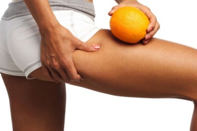 ผู้หญิงกับเซลลูไลท์