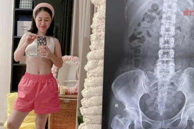 ตุ๊กตา เข็ด อั้นอึจนป่วย ‘โรคขี้เต็มท้อง’ แนะรีบพบแพทย์หาหมอ อย่าหายาทานเอง