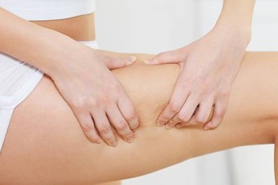 แนะวิธีขจัด เซลลูไลท์ ศัตรูตัวร้ายของผู้หญิง