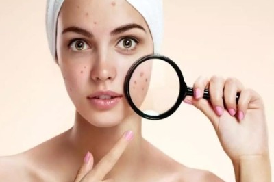 รับมือกับจุดด่างดำ