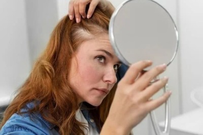 สาวผมบางมาทางนี้ 4 วิธีแก้ผมร่วงง่ายๆ ทำแล้วได้ผลทันใจ